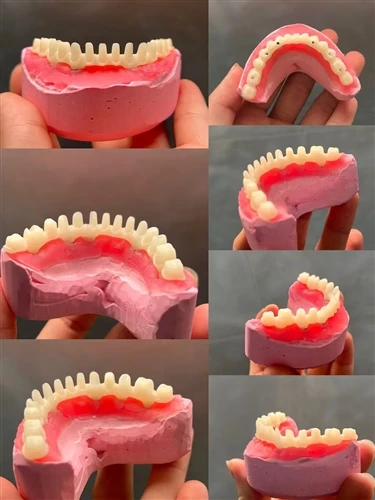 Feedback om restaureringer fra Aident AI-30 Intraoral Scanner Caser